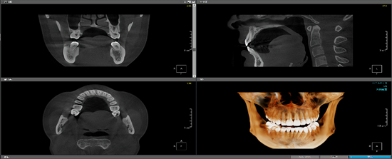 说明: 口腔CT-伯爵S-博恩集团